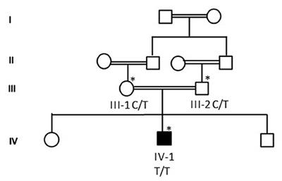 Whole-Exome Sequencing Reveals a Missense Variant c.1612C>T (p.Arg538Cys) in the BTD Gene Leading to Neuromyelitis Optica Spectrum Disorder in Saudi Families